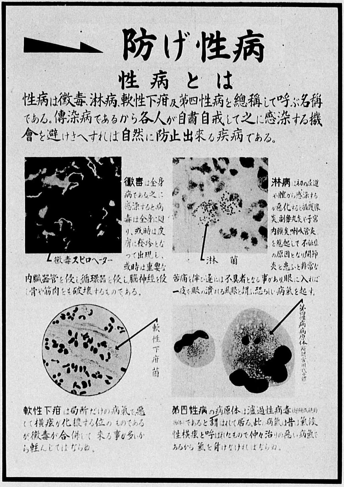 “A Poison to the Race”: Women, Foreigners and VD in Modern Japan – NOTCHES